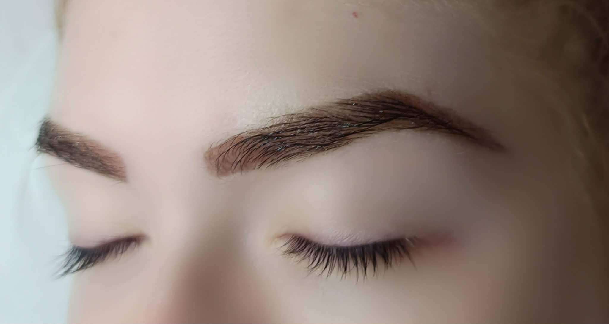 EYE and NECK treatement